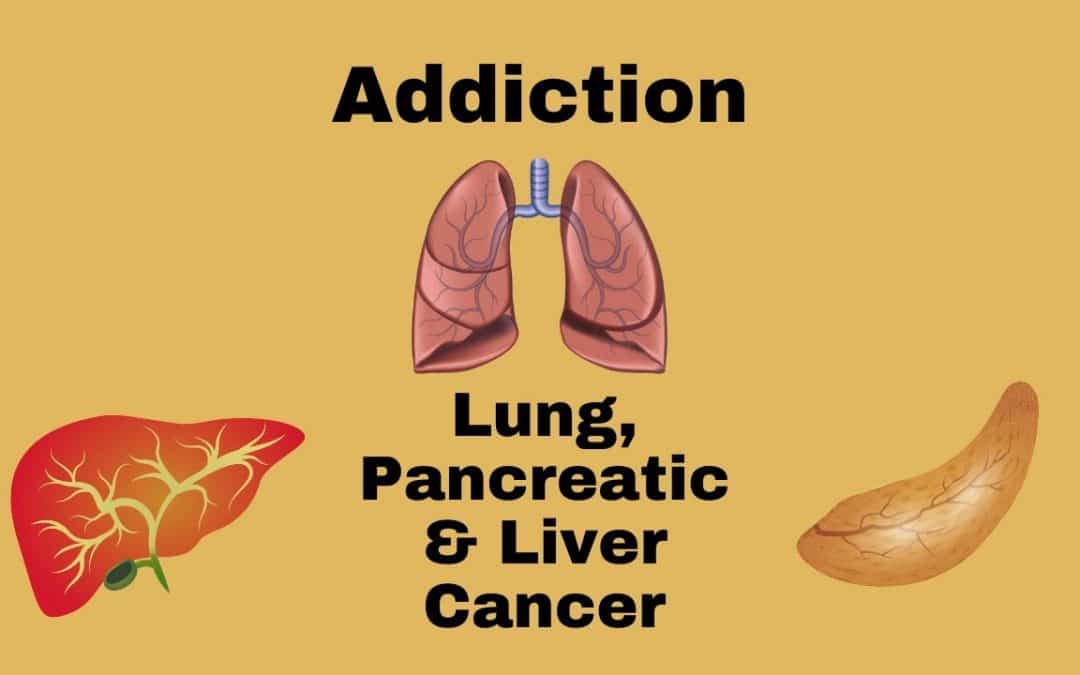 Addiction, Pancreatic and Lung Cancer